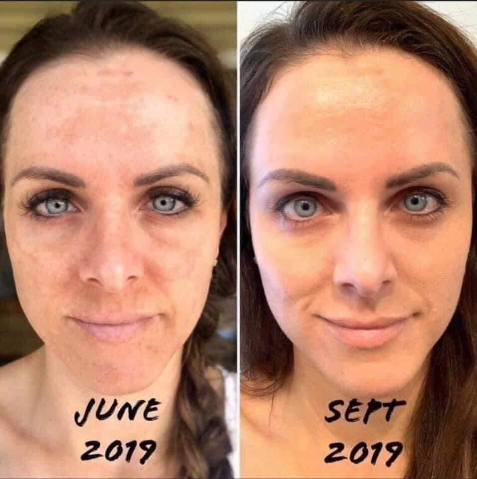 Nu Skin 180°® Face Wash