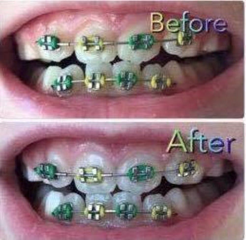 AP 24® Whitening Fluoride Toothpaste