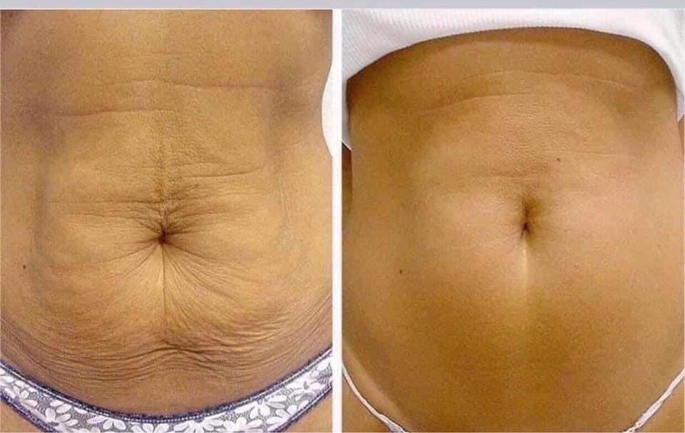 ageLOC® Dermatic Effects