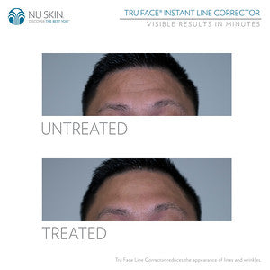 Tru Face® Line Corrector